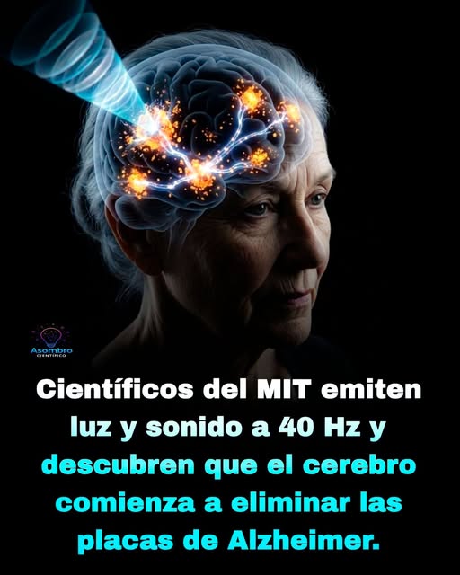 alzheimer, 40hz