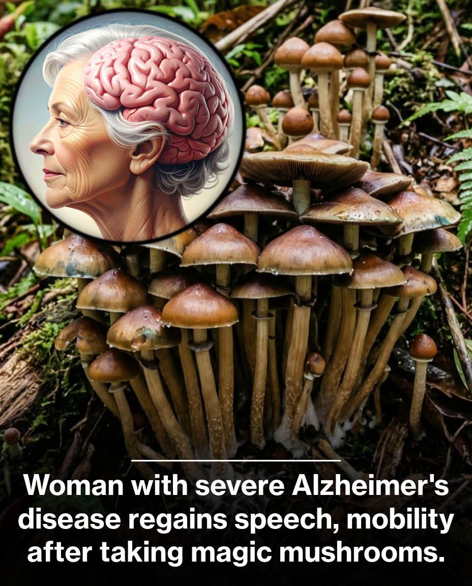 alzheimer, hongos