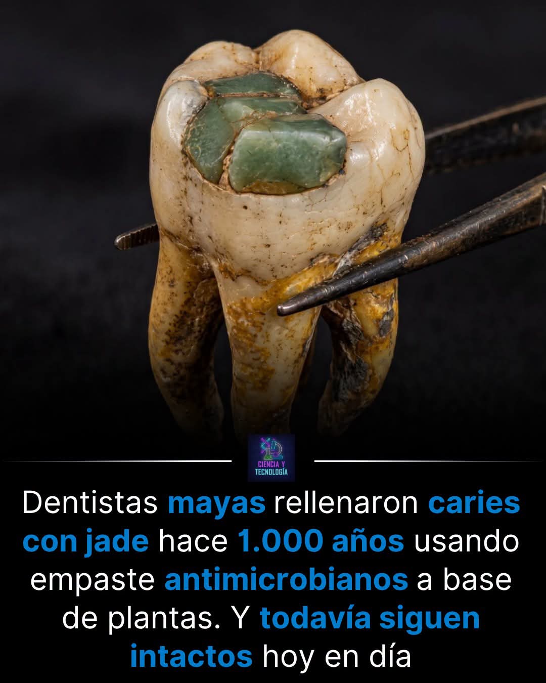 caries, jade