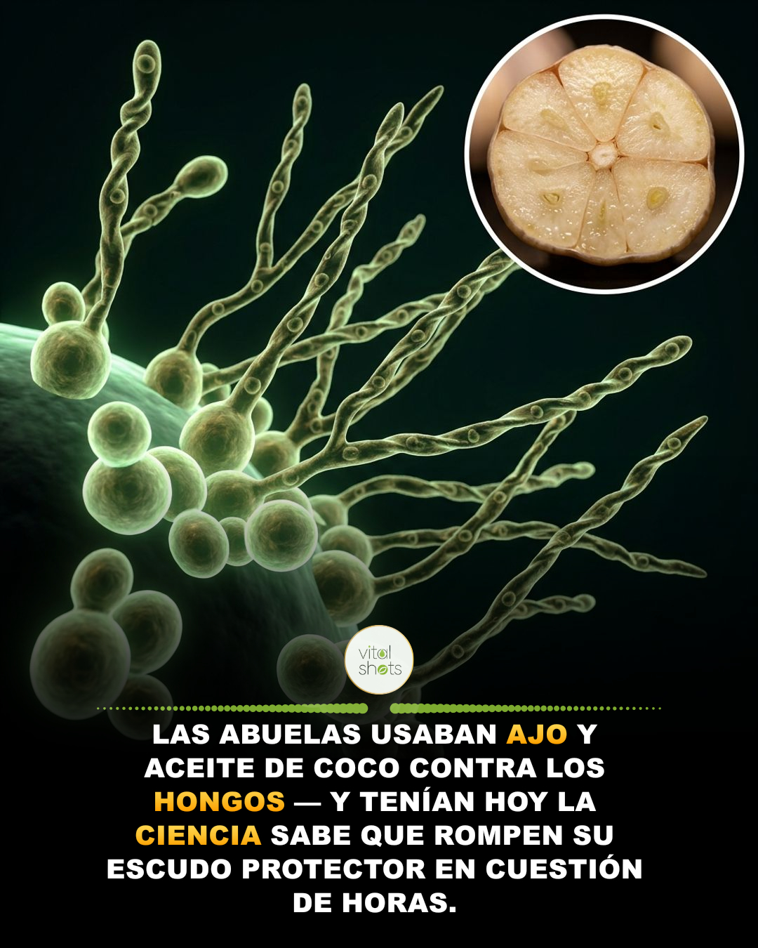 hongos, ajo, aceite, coco