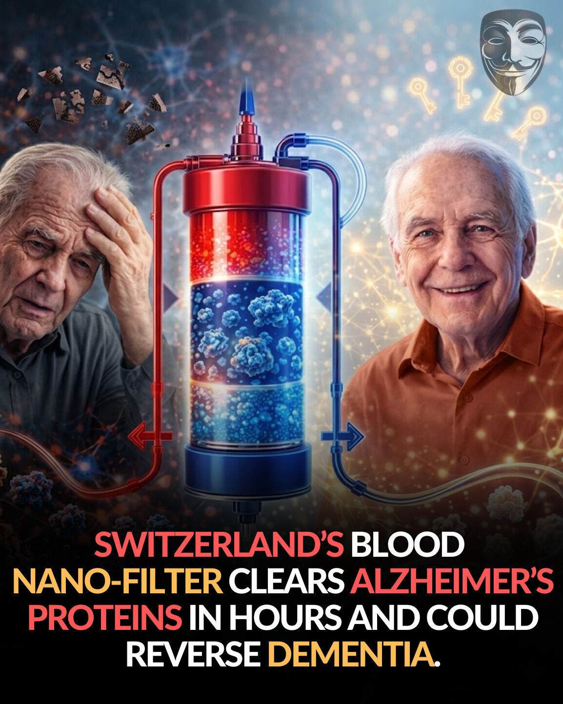 nanofiltro, sangre, alzheimer