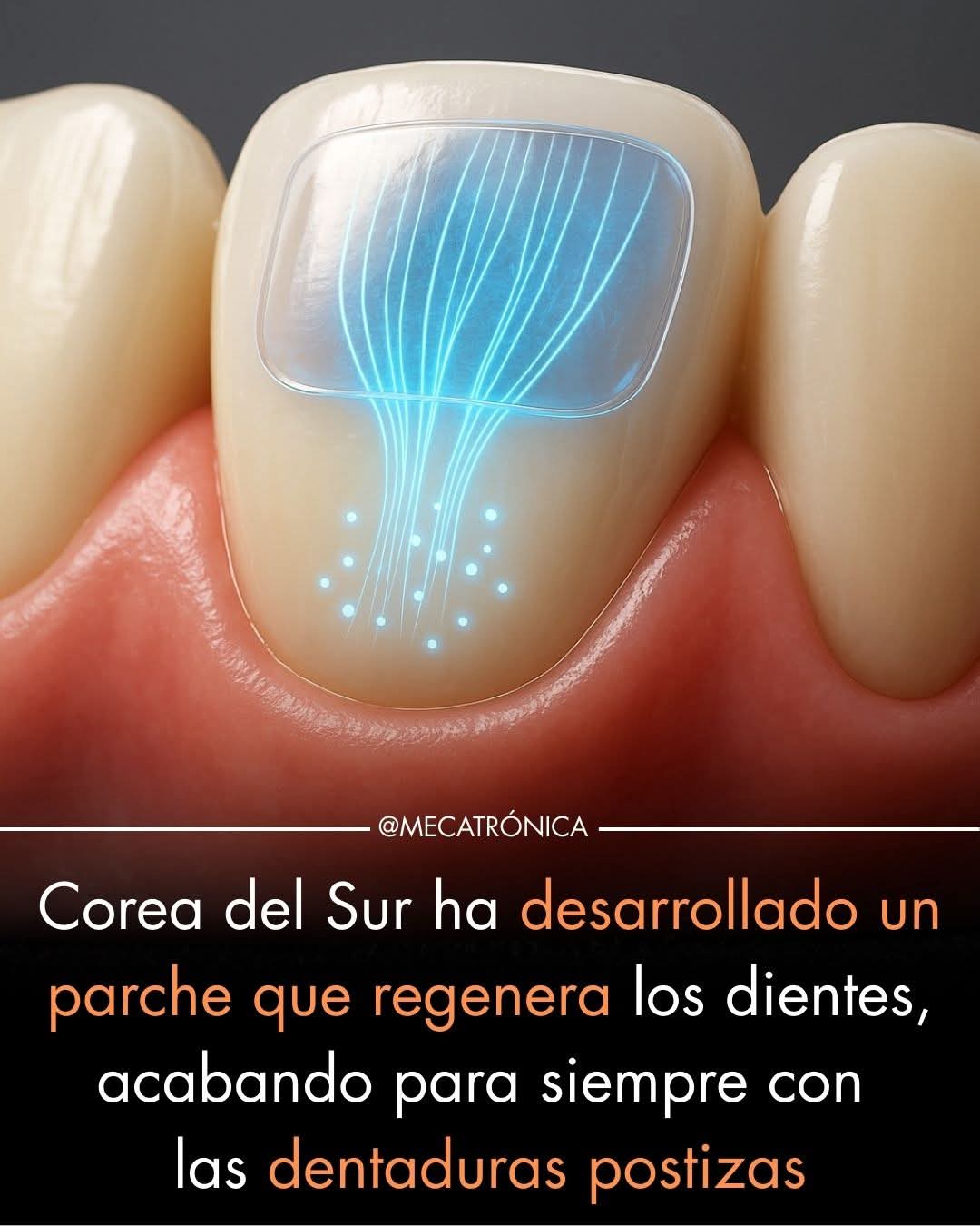 regenerar, dientes