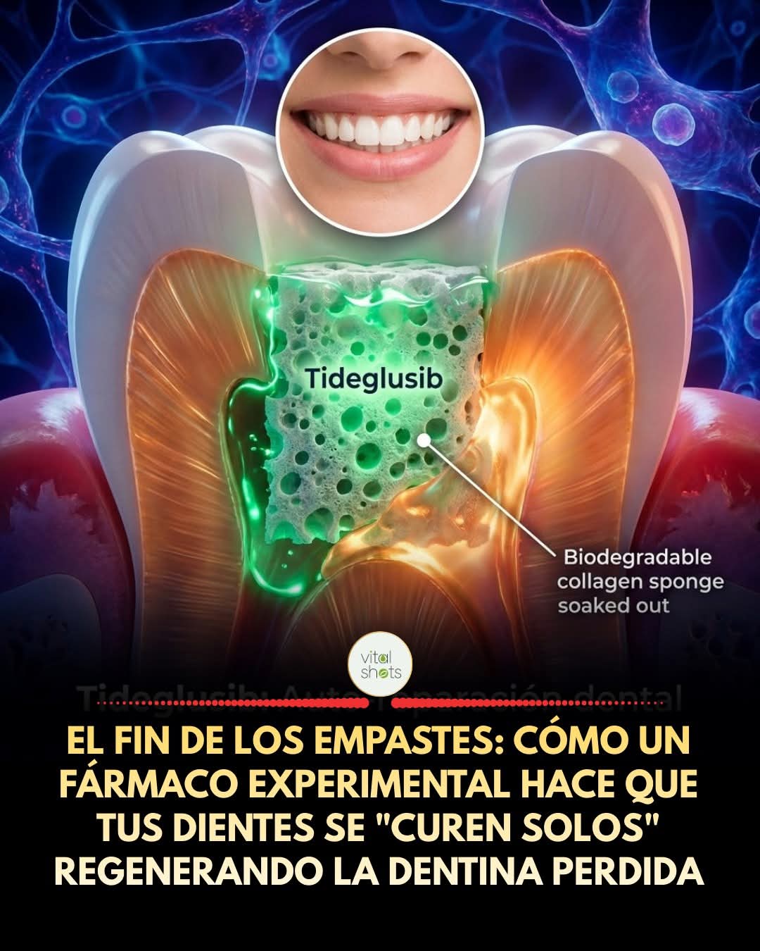 tideglusib, dientes